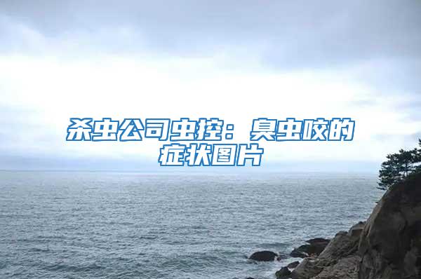 杀虫公司虫控：臭虫咬的症状图片